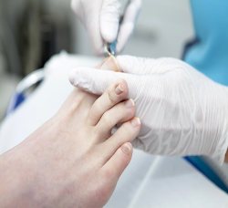 soins de pedicurie, podologie